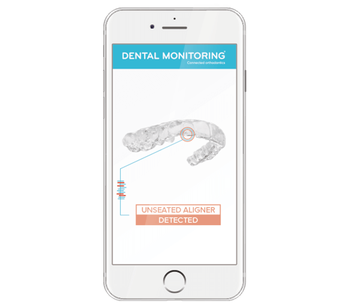 How does Dental
Monitoring work?