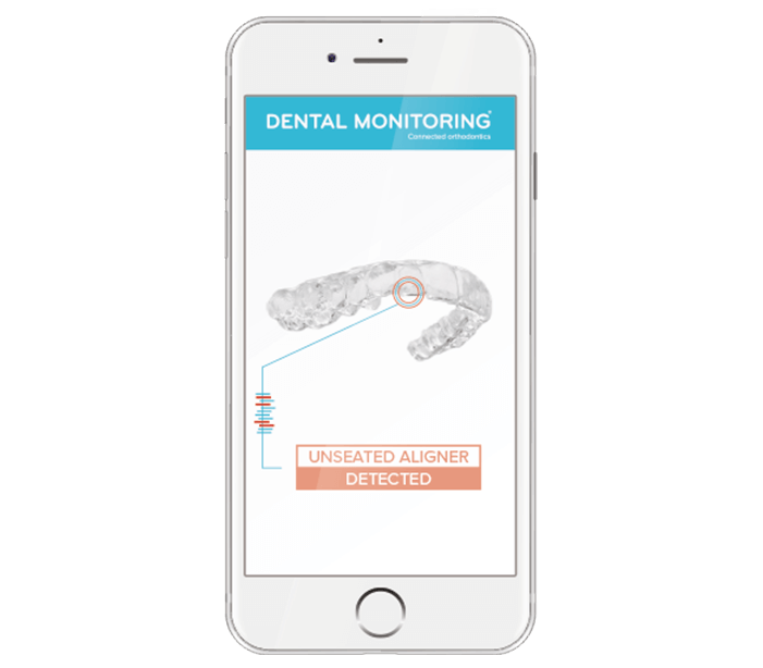 How does Dental
Monitoring work?